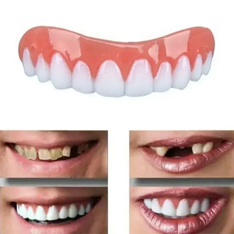 Teeth Whitening With Braces - Novas Próteses Dentárias de Silicone, Facetas