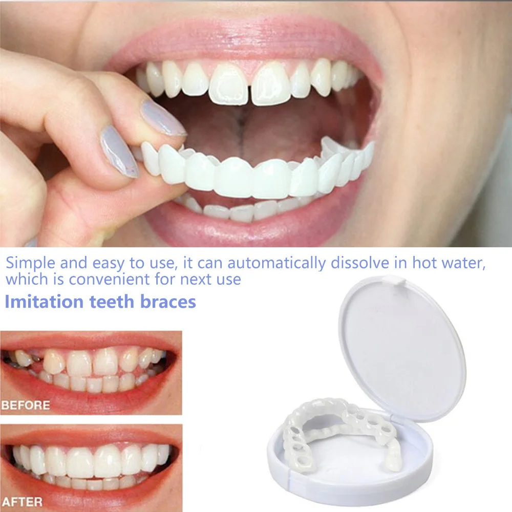 Teeth Whitening With Braces - Sdottor dentes falsos aparelho artificial clareamento