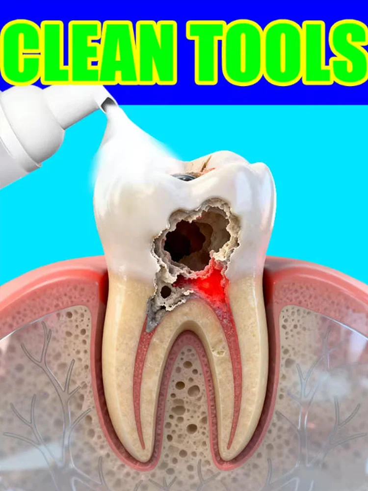 Teeth Whitening Foam - Reparação de Cáries, Proteção e Prevenção