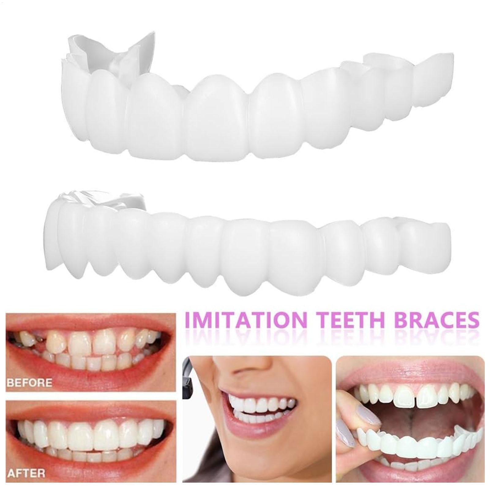 Capa Dentária Superior e Infer - Teeth Whitening With Braces avaliação e preço