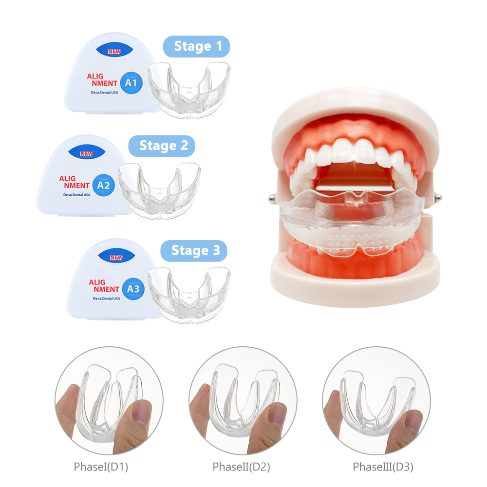 Dental ortodôntico chaves conj - Teeth Whitening With Braces avaliação e preço