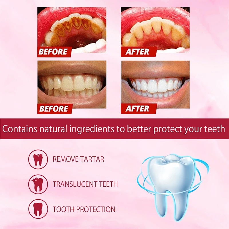 Pasta de Dente Clareadora Prob - Teeth Whitening Enzymes avaliação e preço