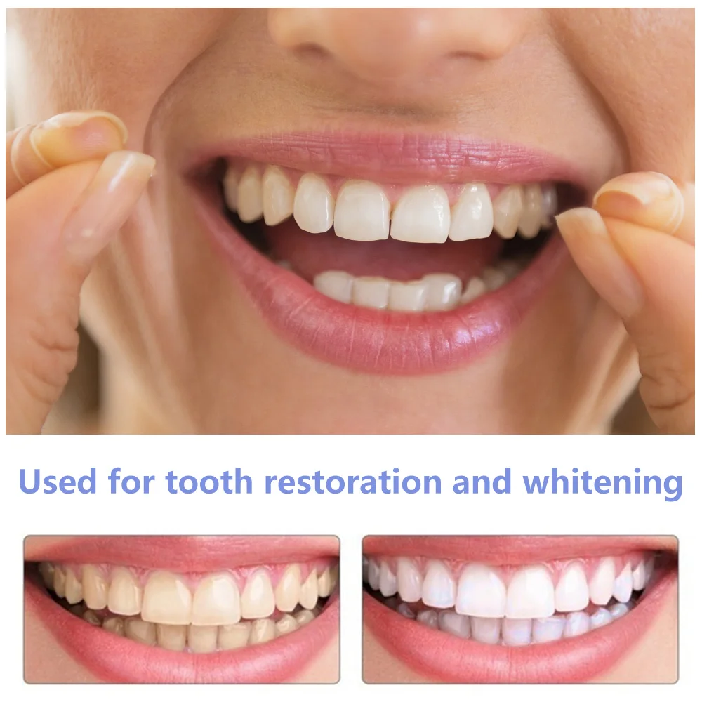 Sdottor dentes falsos aparelho - Teeth Whitening With Braces avaliação e preço