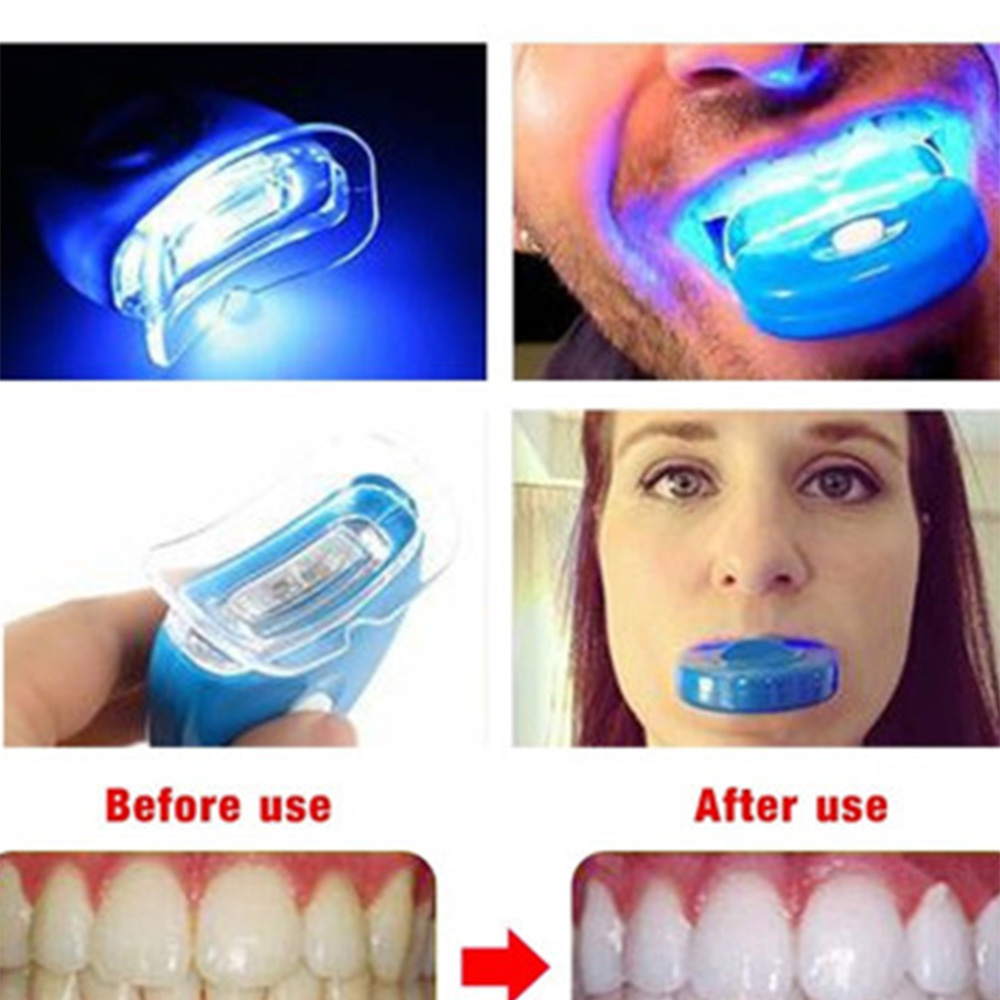Acelerador de clareamento dent - Teeth Whitening Led Kit avaliação e preço