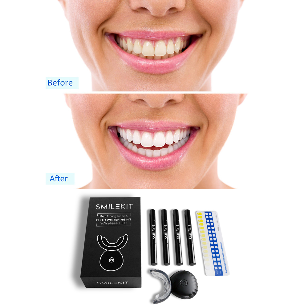 Nova elétrica dentes branqueam - Teeth Whitening Led Kit avaliação e preço